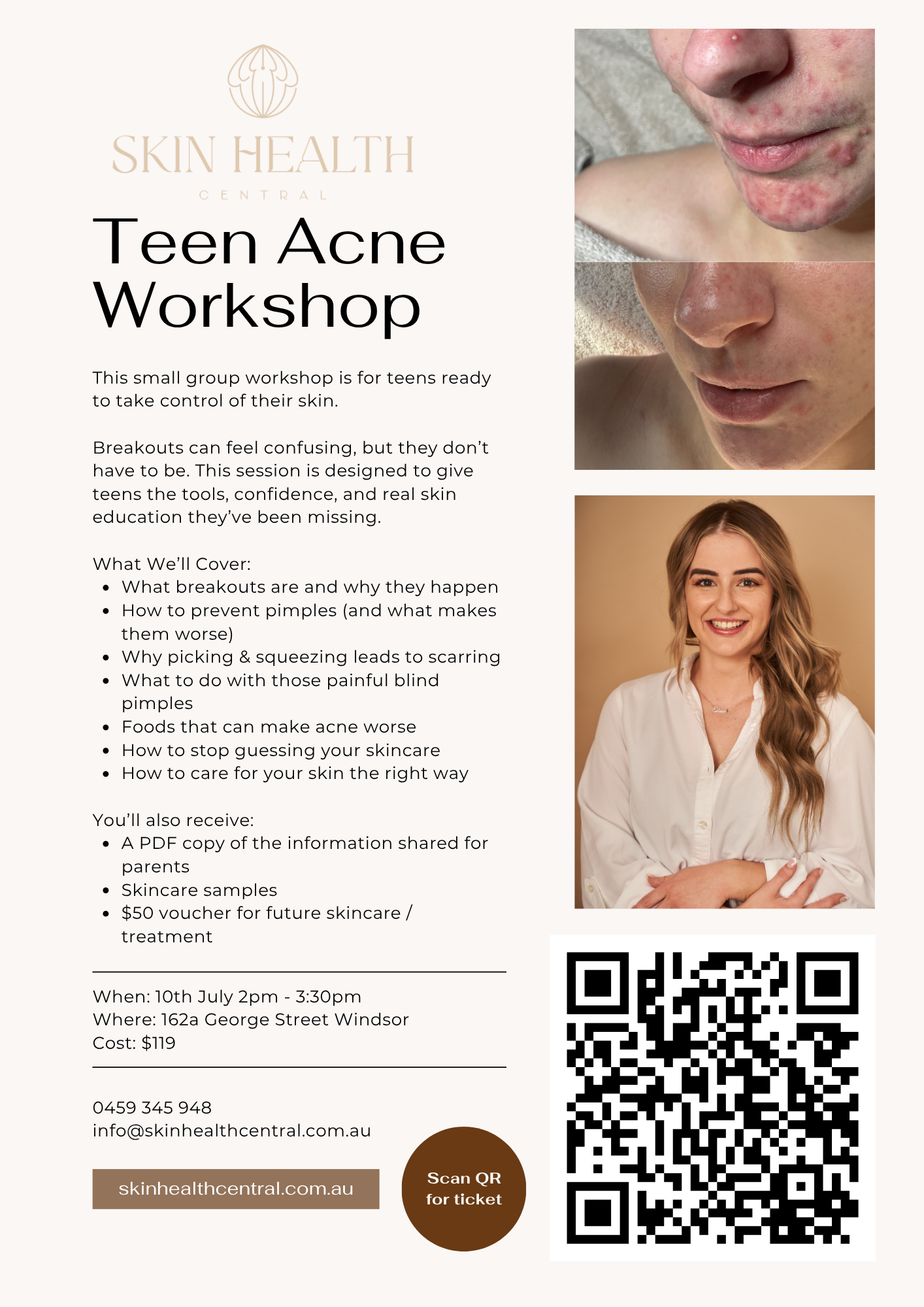 Teen Acne Workshop