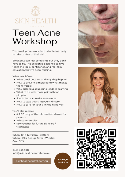 Teen Acne Workshop